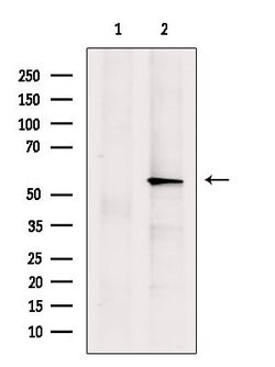 Invitrogen ASM Polyclonal Antibody 100 &mu;L; Unconjugated:Antibodies,