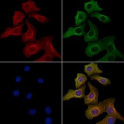 Invitrogen ACOX2 Polyclonal Antibody 100 &mu;L; Unconjugated:Antibodies,