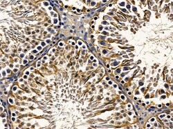 Invitrogen ACOX2 Polyclonal Antibody 100 &mu;L; Unconjugated:Antibodies,