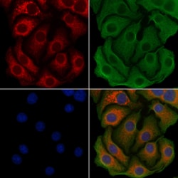 ACSL3 Polyclonal Antibody:Antibodies, Polyclonal