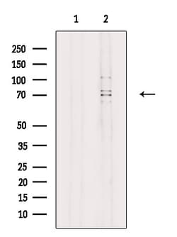 ACSL3 Polyclonal Antibody:Antibodies, Polyclonal
