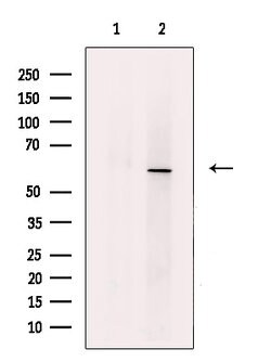 Invitrogen ACVR1 Polyclonal Antibody 100 &mu;L; Unconjugated:Antistoffer
