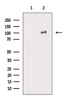 alpha Actinin 1/2/3/4 Polyclonal Antibody 100 &mu;L | Buy Online | Thermo Scientific | Fisher Scientific