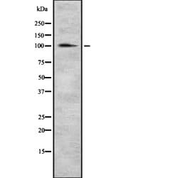 alpha Actinin 2 Polyclonal Antibody:Antibodies, Polyclonal