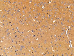 Invitrogen ACTR1A Polyclonal Antibody 100 &mu;L; Unconjugated:Antibodies,