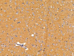 Invitrogen ACTR1A Polyclonal Antibody 100 &mu;L; Unconjugated:Antibodies,