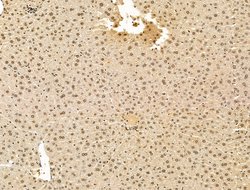 Invitrogen ADCY10 Polyclonal Antibody 100 μL; Unconjugated:Antibodies,