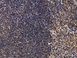 Invitrogen ADCY10 Polyclonal Antibody 100 μL; Unconjugated:Antibodies,
