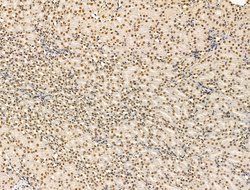 Invitrogen ADCY10 Polyclonal Antibody 100 μL; Unconjugated:Antibodies,