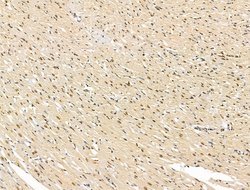 Invitrogen ADCY10 Polyclonal Antibody 100 μL; Unconjugated:Antibodies,