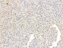 Invitrogen ADCY10 Polyclonal Antibody 100 μL; Unconjugated:Antibodies,