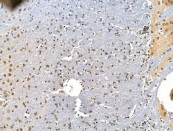 Invitrogen ADCY10 Polyclonal Antibody 100 μL; Unconjugated:Antibodies,
