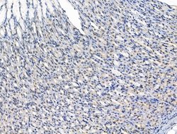 Invitrogen ADCY10 Polyclonal Antibody 100 μL; Unconjugated:Antibodies,