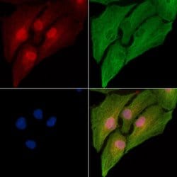 alpha-1b Adrenergic Receptor Polyclonal Antibody, Invitrogen 100 &mu;L;