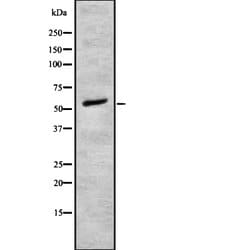 alpha-1b Adrenergic Receptor Polyclonal Antibody, Invitrogen 100 &mu;L;
