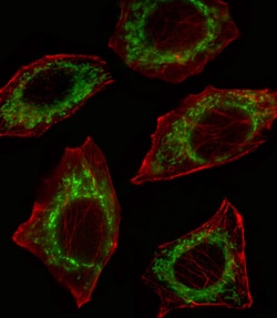 Invitrogen ALDH2 Polyclonal Antibody 400 &mu;L; Unconjugated:Antibodies