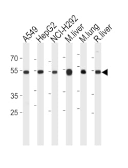Invitrogen ALDH2 Polyclonal Antibody 400 &mu;L; Unconjugated:Antibodies