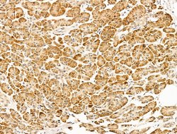 Invitrogen EEF1E1 Polyclonal Antibody 100 &mu;L; Unconjugated:Antibodies,