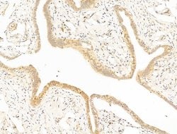 Invitrogen EEF1E1 Polyclonal Antibody 100 &mu;L; Unconjugated:Antibodies,