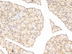Invitrogen EEF1E1 Polyclonal Antibody 100 &mu;L; Unconjugated:Antibodies,