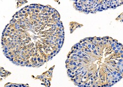 Invitrogen AKAP12 Polyclonal Antibody 100 &mu;L | Buy Online | Invitrogen&trade; | Fisher Scientific