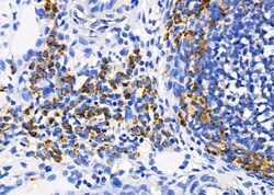 Invitrogen AKAP12 Polyclonal Antibody 100 &mu;L | Buy Online | Invitrogen&trade; | Fisher Scientific