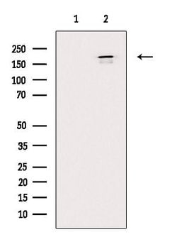Invitrogen AKAP12 Polyclonal Antibody 100 &mu;L | Buy Online | Invitrogen&trade; | Fisher Scientific