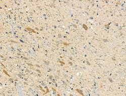 Invitrogen ALDH1A2 Polyclonal Antibody 100 &mu;L; Unconjugated:Antibodies,