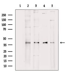 Invitrogen Aldolase Polyclonal Antibody 100 &mu;L; Unconjugated:Antibodies,