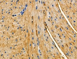 Invitrogen Aldolase Polyclonal Antibody 100 &mu;L; Unconjugated:Antibodies,
