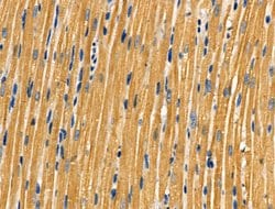 Invitrogen Aldolase Polyclonal Antibody 100 &mu;L; Unconjugated:Antibodies,