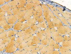 Invitrogen Aldolase Polyclonal Antibody 100 &mu;L; Unconjugated:Antibodies,