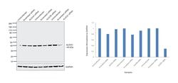 Invitrogen Aldolase C Polyclonal Antibody 100 μL; Unconjugated:Antibodies,
