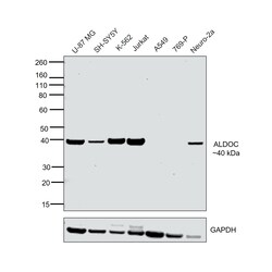 Invitrogen Aldolase C Polyclonal Antibody 100 μL; Unconjugated:Antibodies,