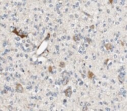 Invitrogen Aldolase C Polyclonal Antibody 100 μL; Unconjugated:Antibodies,