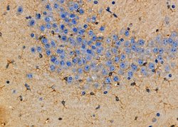 Invitrogen Aldolase C Polyclonal Antibody 100 μL; Unconjugated:Antibodies,