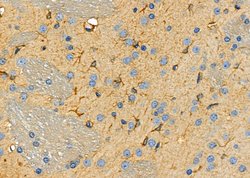 Invitrogen Aldolase C Polyclonal Antibody 100 μL; Unconjugated:Antibodies,
