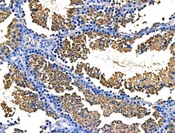 Invitrogen Spectrin alpha-1 Polyclonal Antibody 100 &mu;L; Unconjugated:Antibodies,
