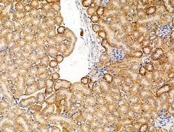 Invitrogen Spectrin alpha-1 Polyclonal Antibody 100 &mu;L; Unconjugated:Antibodies,