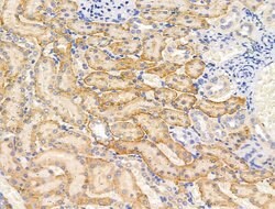 Invitrogen Spectrin alpha-1 Polyclonal Antibody 100 &mu;L; Unconjugated:Antibodies,