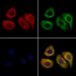 Invitrogen AMD1 Polyclonal Antibody 100 &mu;L; Unconjugated:Antibodies,
