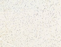 Invitrogen Aes Polyclonal Antibody 100 &mu;L; Unconjugated:Antibodies,