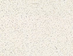 Invitrogen Aes Polyclonal Antibody 100 &mu;L; Unconjugated:Antibodies,