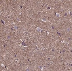 Invitrogen ANKRD26 Polyclonal Antibody 100 &mu;L; Unconjugated:Antibodies,
