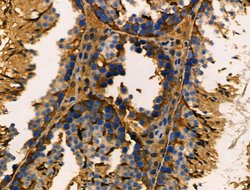 Invitrogen ANKRD26 Polyclonal Antibody 100 &mu;L; Unconjugated:Antibodies,