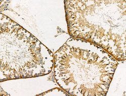 Invitrogen ANKRD26 Polyclonal Antibody 100 &mu;L; Unconjugated:Antibodies,