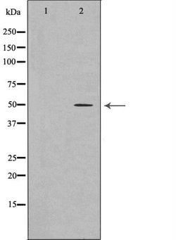 Invitrogen AP2M1 Polyclonal Antibody 100 &mu;L; Unconjugated:Antibodies,