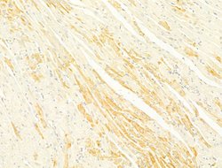 Invitrogen Protein APC Polyclonal Antibody 100 μL; Unconjugated:Antibodies,