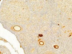 Invitrogen Protein APC Polyclonal Antibody 100 μL; Unconjugated:Antibodies,