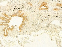 Invitrogen Protein APC Polyclonal Antibody 100 μL; Unconjugated:Antibodies,